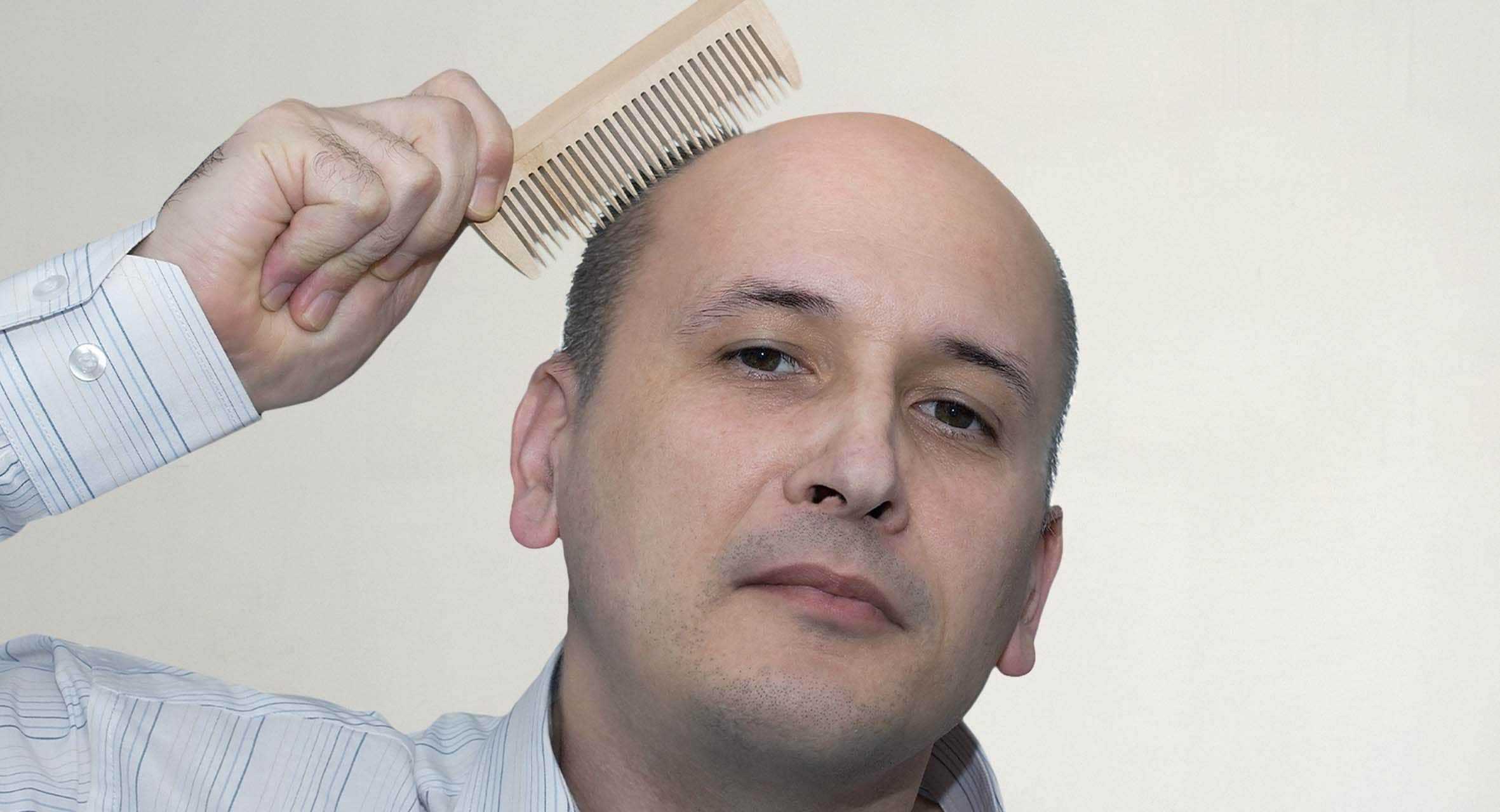 صورة كيف تحدد الوقت المناسب لحلاقة شعرك بأكمله والتصالح مع حقيقة أنك أصلع